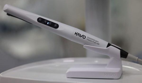 Dijagnostikovanje karijesa jednim klikom: Najnovije tehnologije u Lavin Dental