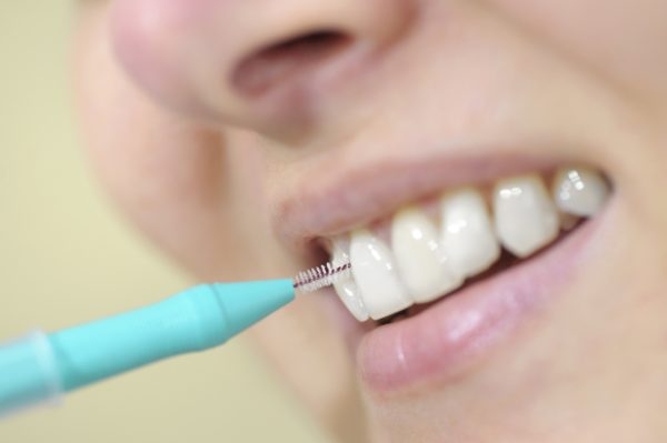 Interdentalne četkice umesto konca za zube: Sve što treba da znate